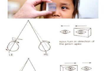 20 diopter base out prism test