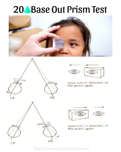 20 diopter base out prism test